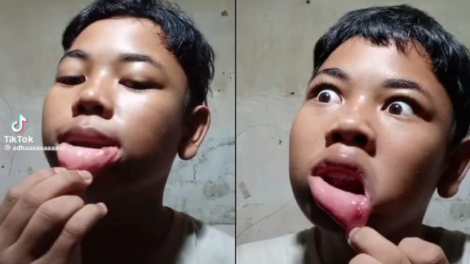 
					Aksi Kocak Seorang Bocah Coba Sembuhkan Sariawan dengan Lada Bubuk